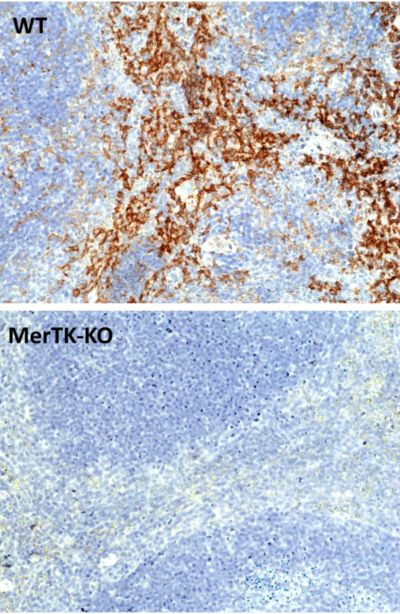 MERTK Antibody in Immunohistochemistry (Paraffin) (IHC (P))