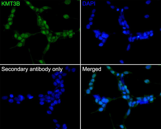 NSD1 Antibody in Immunocytochemistry (ICC/IF)