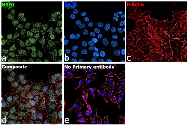 NSD1 Antibody in Immunocytochemistry (ICC/IF)