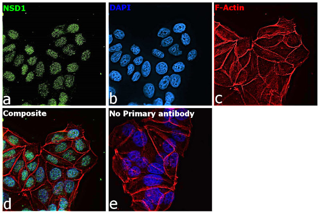 NSD1 Antibody in Immunocytochemistry (ICC/IF)