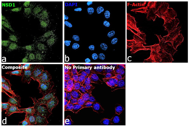 NSD1 Antibody in Immunocytochemistry (ICC/IF)