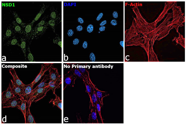 NSD1 Antibody in Immunocytochemistry (ICC/IF)