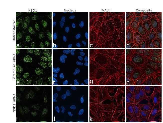 NSD1 Antibody in Immunocytochemistry (ICC/IF)