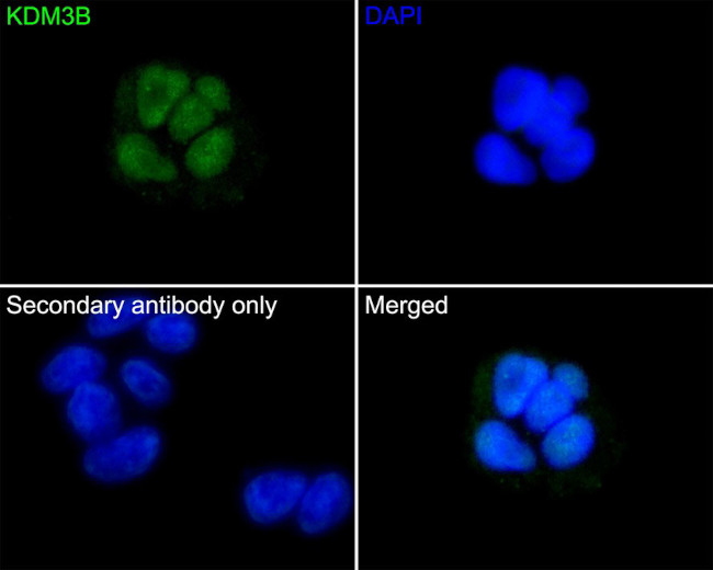 JMJD1B Antibody in Immunocytochemistry (ICC/IF)