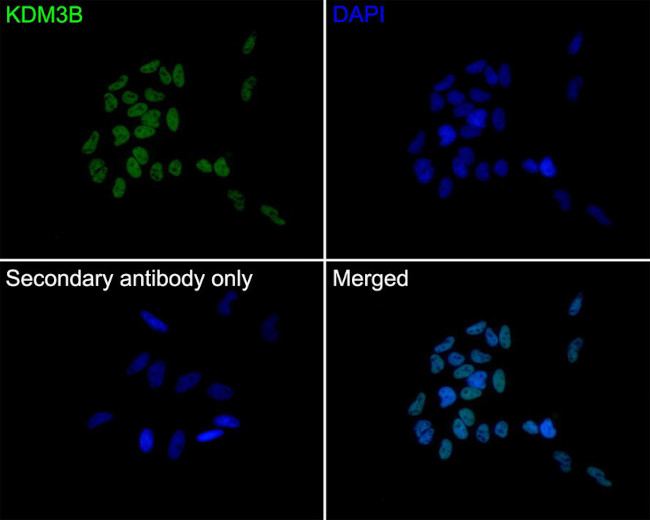 JMJD1B Antibody in Immunocytochemistry (ICC/IF)