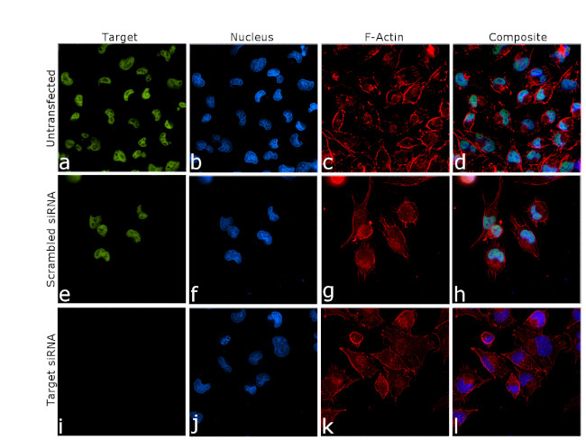 JMJD1B Antibody