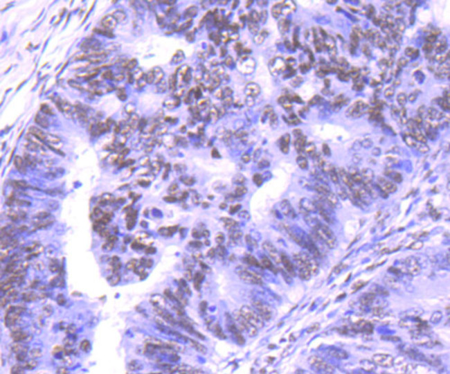 PTBP1 Antibody in Immunohistochemistry (Paraffin) (IHC (P))