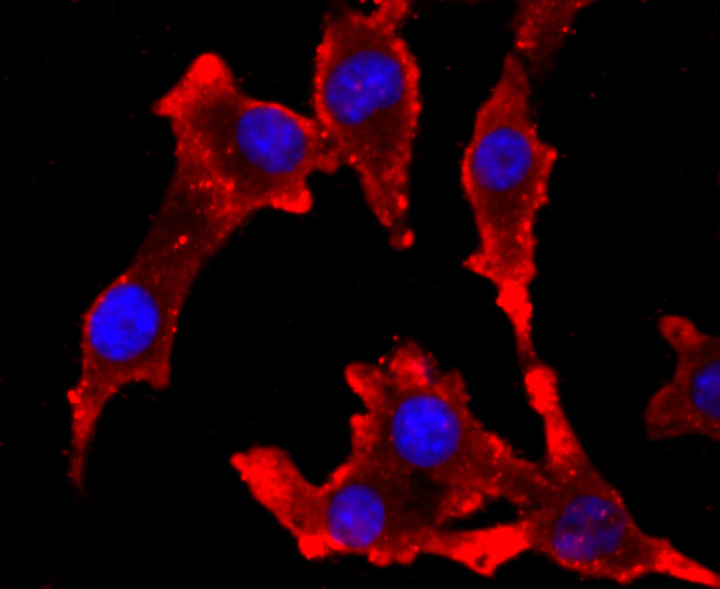 Tyrosinase Antibody in Immunocytochemistry (ICC/IF)