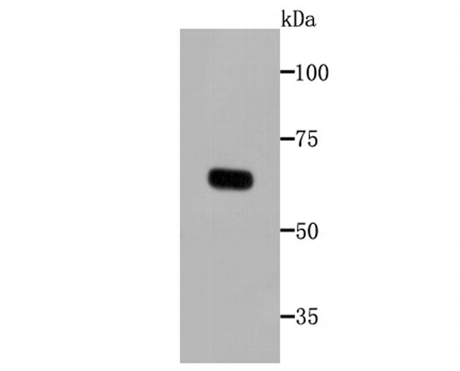 Tyrosinase Antibody in Western Blot (WB)