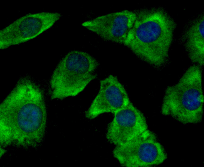 gamma Tubulin Antibody in Immunocytochemistry (ICC/IF)