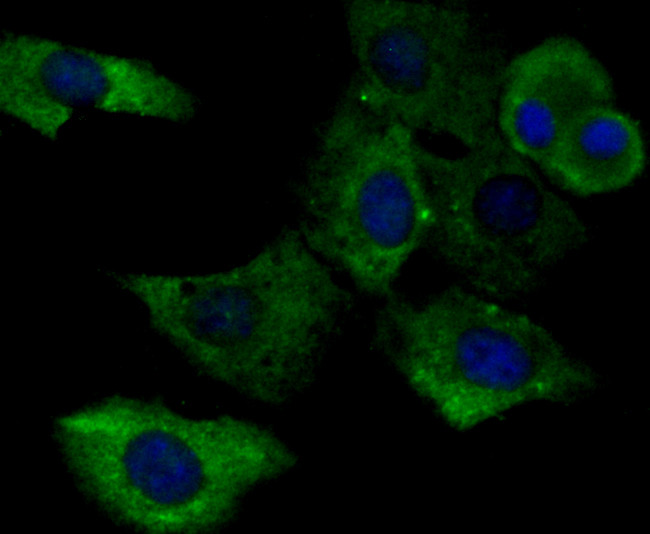 gamma Tubulin Antibody in Immunocytochemistry (ICC/IF)