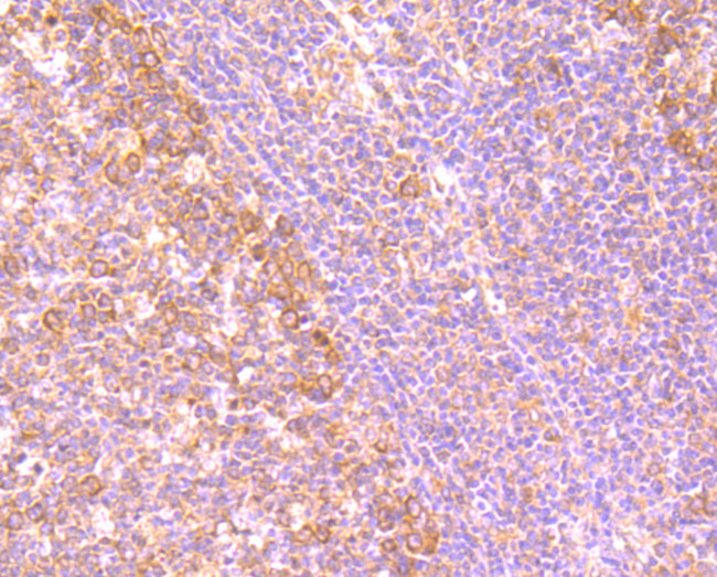 gamma Tubulin Antibody in Immunohistochemistry (Paraffin) (IHC (P))