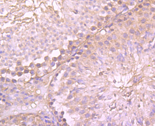 gamma Tubulin Antibody in Immunohistochemistry (Paraffin) (IHC (P))