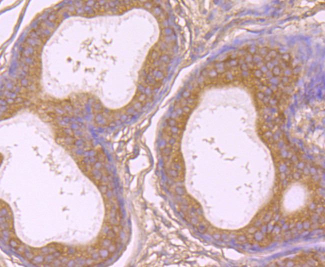 gamma Tubulin Antibody in Immunohistochemistry (Paraffin) (IHC (P))