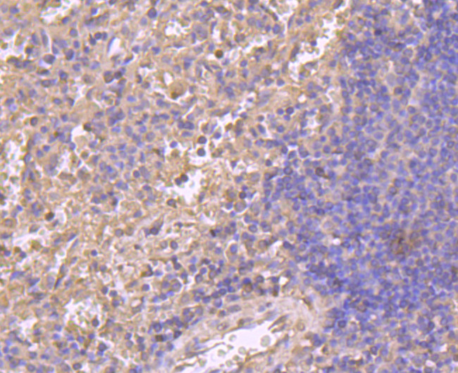 Cyclin A2 Antibody in Immunohistochemistry (Paraffin) (IHC (P))