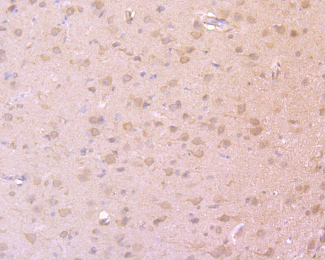 PSD-95 Antibody in Immunohistochemistry (Paraffin) (IHC (P))