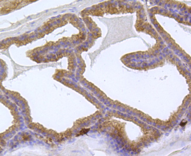 EEA1 Antibody in Immunohistochemistry (Paraffin) (IHC (P))