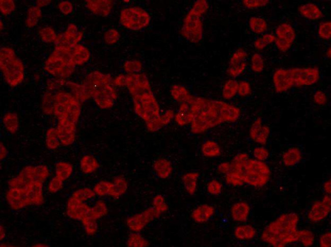 JAK2 Antibody in Immunocytochemistry (ICC/IF)