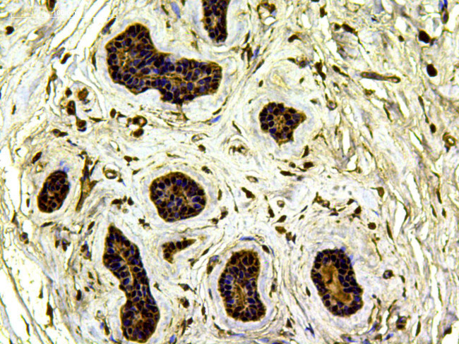 JAK2 Antibody in Immunohistochemistry (Paraffin) (IHC (P))