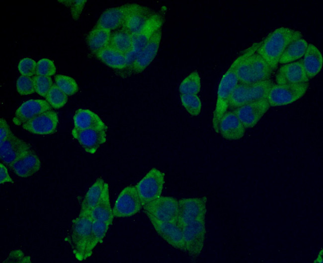 Desmin Antibody in Immunocytochemistry (ICC/IF)