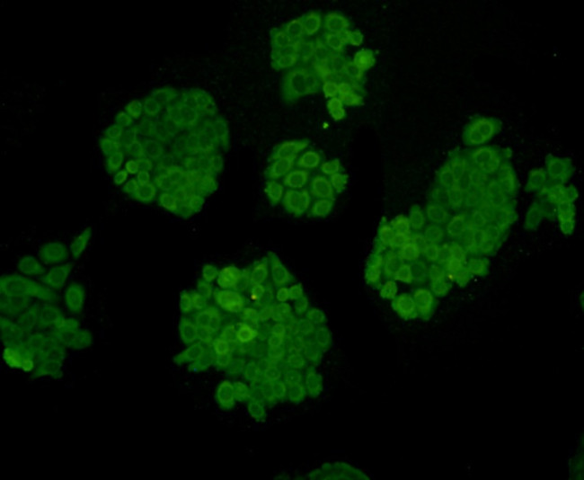 Desmin Antibody in Immunocytochemistry (ICC/IF)