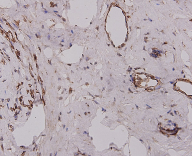 Desmin Antibody in Immunohistochemistry (Paraffin) (IHC (P))