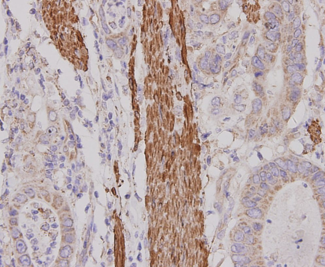 Desmin Antibody in Immunohistochemistry (Paraffin) (IHC (P))