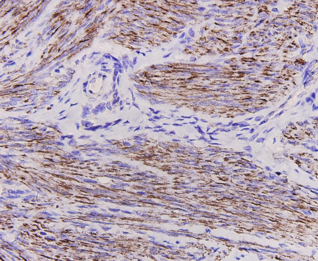 Desmin Antibody in Immunohistochemistry (Paraffin) (IHC (P))