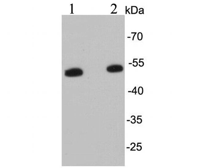 Desmin Antibody in Western Blot (WB)