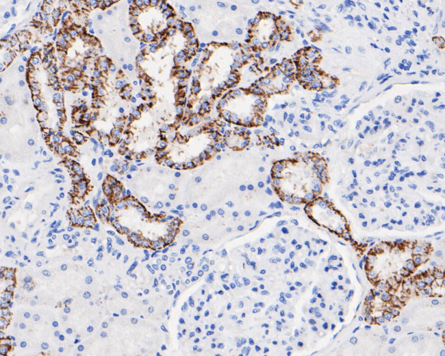 Claudin 7 Antibody in Immunohistochemistry (Paraffin) (IHC (P))