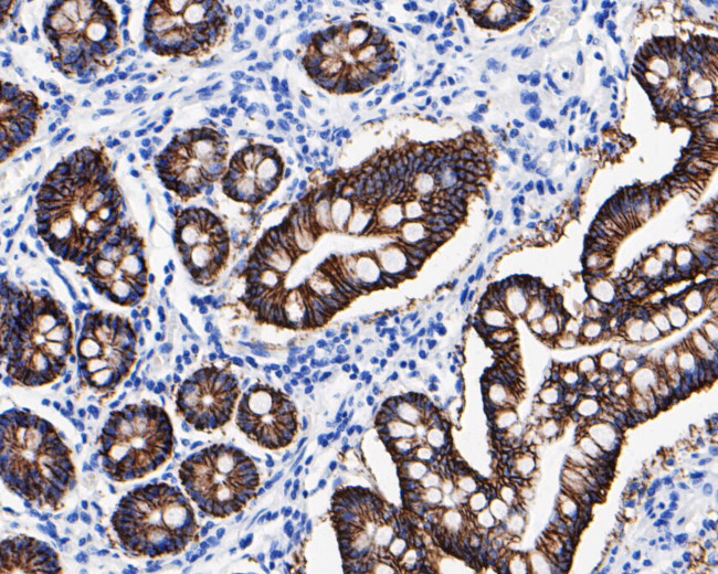 Claudin 7 Antibody in Immunohistochemistry (Paraffin) (IHC (P))