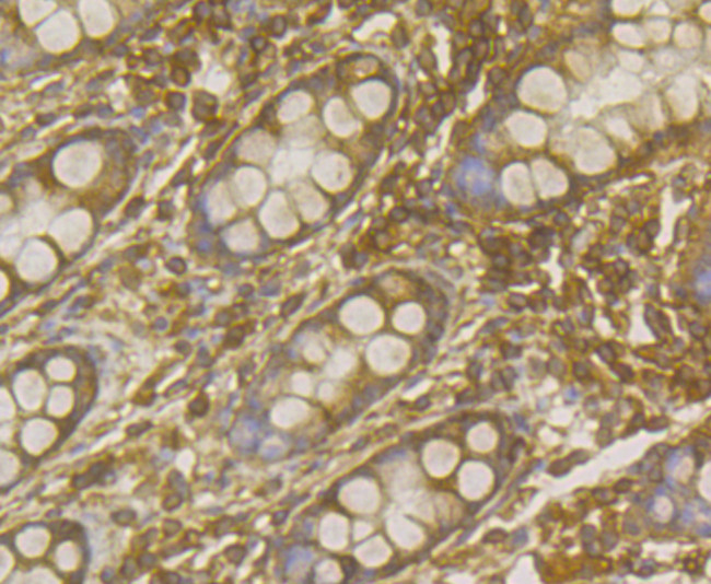 ERK2 Antibody in Immunohistochemistry (Paraffin) (IHC (P))