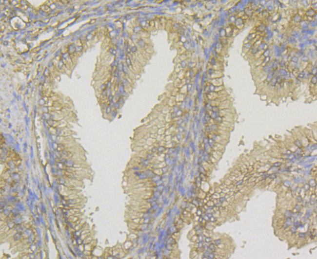 ERK2 Antibody in Immunohistochemistry (Paraffin) (IHC (P))