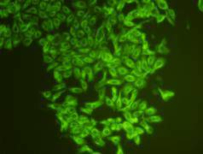 beta Tubulin Antibody in Immunocytochemistry (ICC/IF)