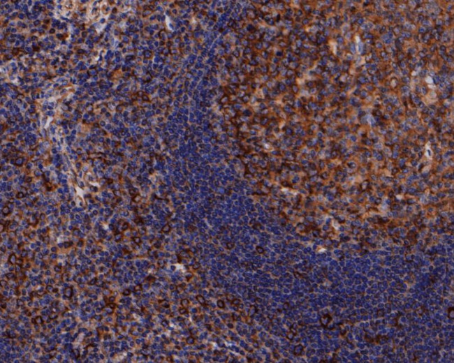 beta Tubulin Antibody in Immunohistochemistry (Paraffin) (IHC (P))