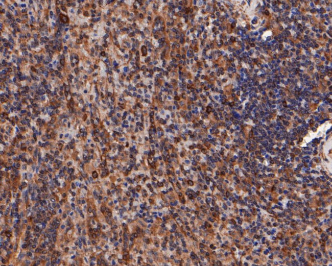 beta Tubulin Antibody in Immunohistochemistry (Paraffin) (IHC (P))