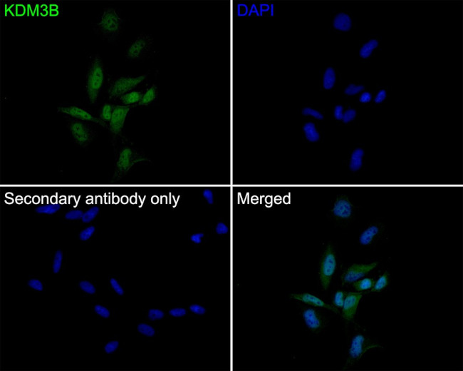 JMJD1B Antibody in Immunocytochemistry (ICC/IF)