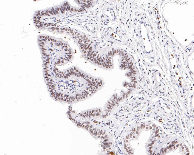 JMJD1B Antibody in Immunohistochemistry (Paraffin) (IHC (P))