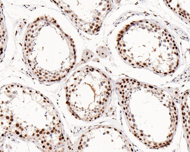 JMJD1B Antibody in Immunohistochemistry (Paraffin) (IHC (P))