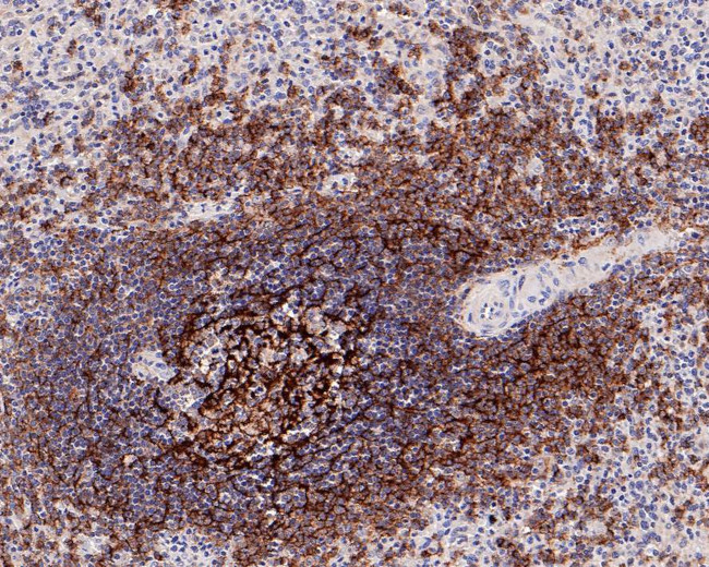 CD21 Antibody in Immunohistochemistry (Paraffin) (IHC (P))