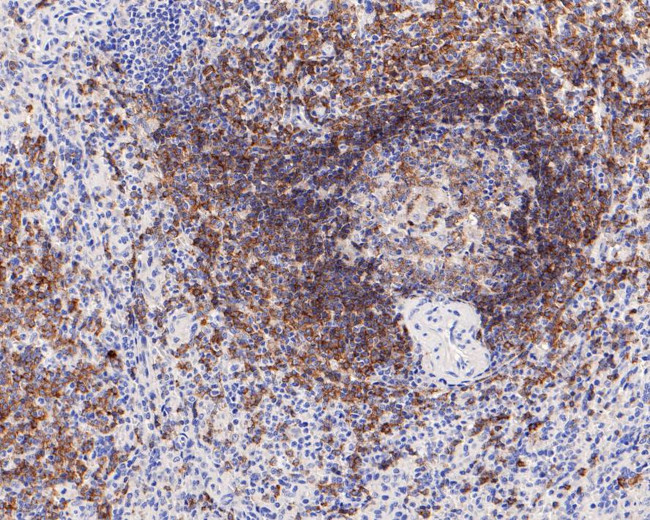 CD22 Antibody in Immunohistochemistry (Paraffin) (IHC (P))