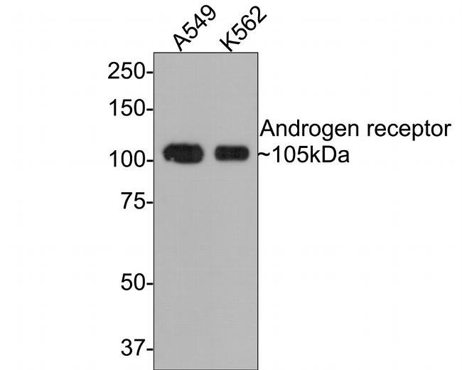 Androgen Receptor Antibody in Western Blot (WB)