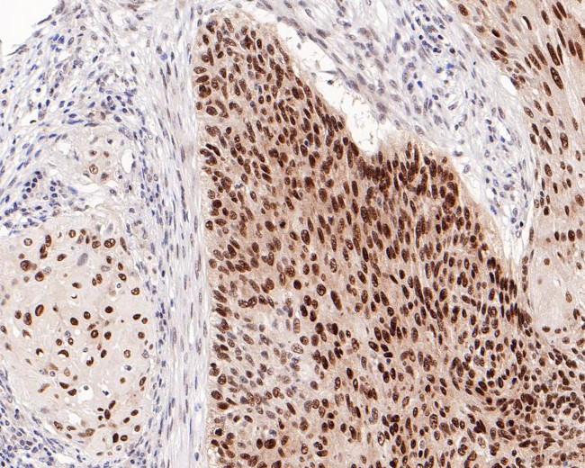 SOX2 Antibody in Immunohistochemistry (Paraffin) (IHC (P))