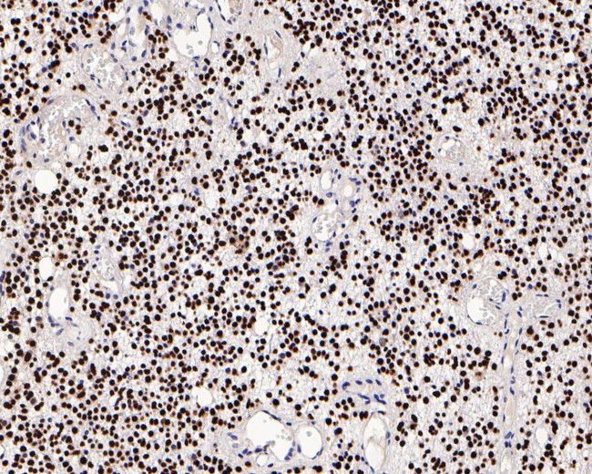 SOX2 Antibody in Immunohistochemistry (Paraffin) (IHC (P))