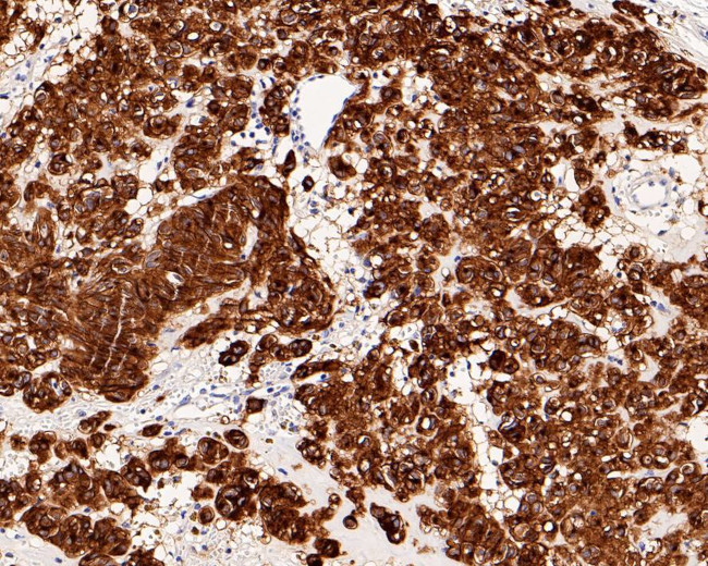 c-Kit Antibody in Immunohistochemistry (Paraffin) (IHC (P))