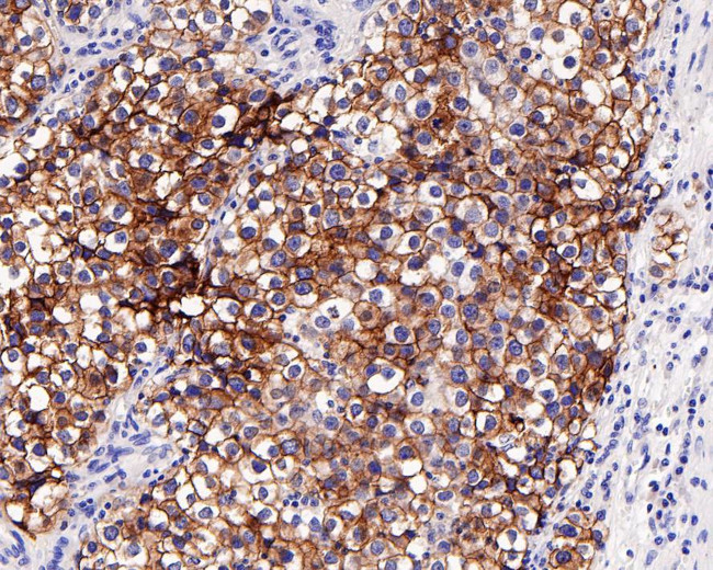 c-Kit Antibody in Immunohistochemistry (Paraffin) (IHC (P))