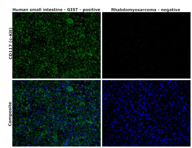 c-Kit Antibody in Immunohistochemistry (Paraffin) (IHC (P))