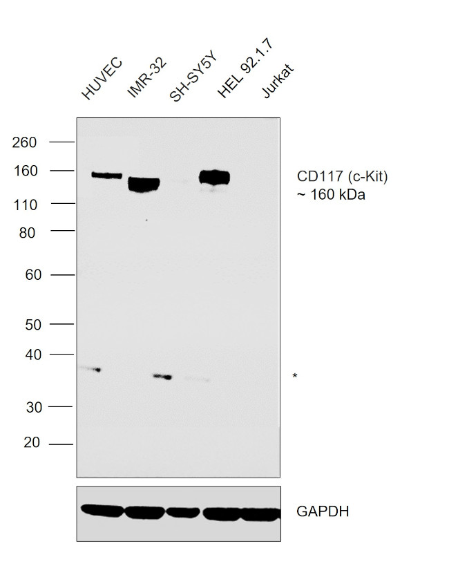 c-Kit Antibody in Western Blot (WB)