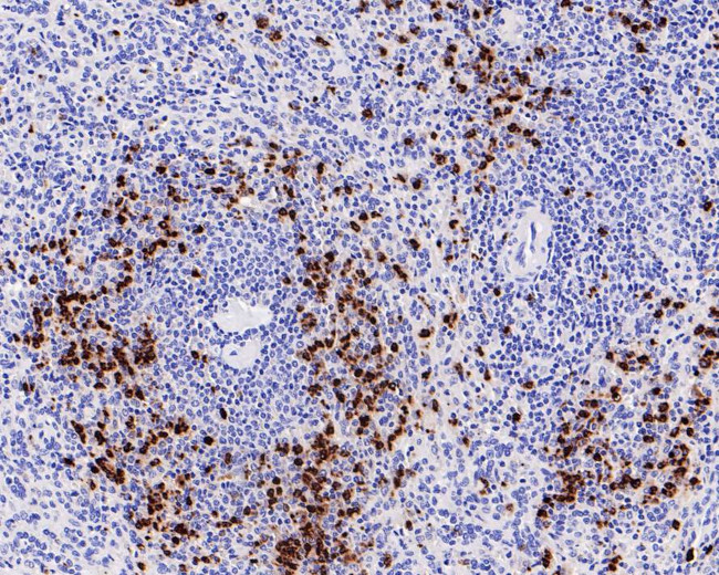 Myeloperoxidase Antibody in Immunohistochemistry (Paraffin) (IHC (P))