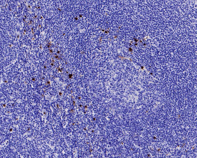 Myeloperoxidase Antibody in Immunohistochemistry (Paraffin) (IHC (P))